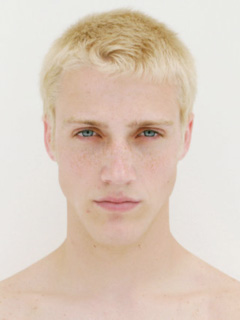 fototipo I